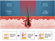 Load image into Gallery viewer, Hair growth cap