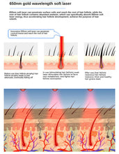 Load image into Gallery viewer, Hair growth cap