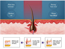 Load image into Gallery viewer, Hair growth cap
